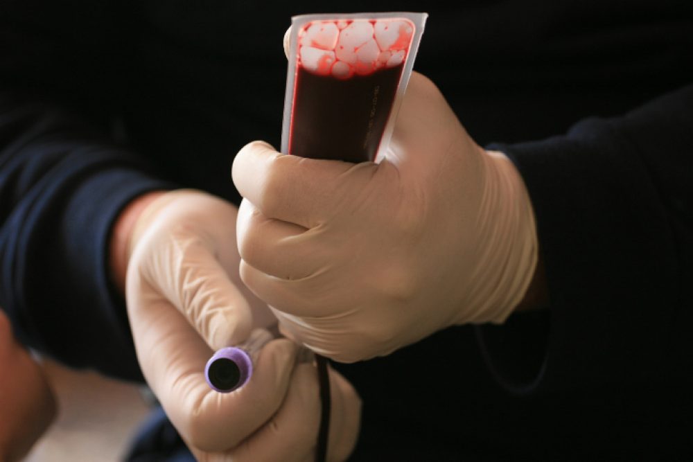 Illustration of blood taken from donors by Magen David Adom (Red Star of David), Jerusale