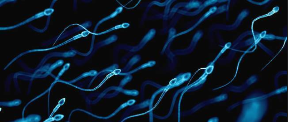 sperm